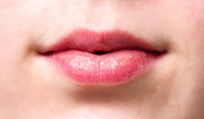 The Main Causes of Dry Lips